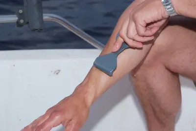 Voluntario dentro de una embarcación aplicando la espátula Meduclean en su piel tras una picadura de medusa Pelagia noctiluca.