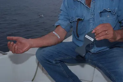 Voluntario probando la espátula Meduclean a bordo de una embarcación tras una picadura de medusa Pelagia noctiluca.